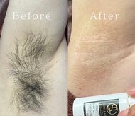 スキンリープワックスサロン 二子玉川店(SKINLEAP Wax salon)