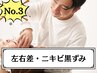 むくみ×ゆがみケア◎美容鍼＋小顔エステ¥14000→¥7980