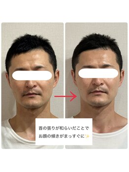 エクラ(e'clat)/左右差が整う方も♪