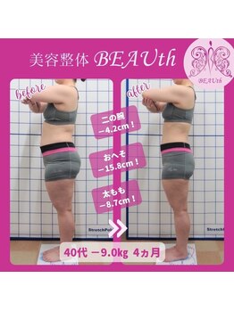 北生駒整骨院 押熊院/お客様Before＆After