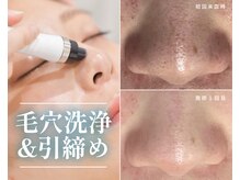 ルポ 鶴見(Repos)/【毛穴洗浄×プラズマ】1回