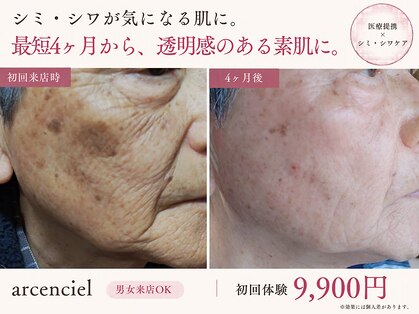 アルカンシエル(arcenciel)の写真