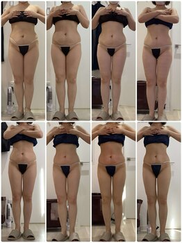 プラチナアース つくば店(Platinum earth)/痩身ビフォーアフター