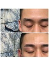 アイビー 神保町店(i.b)/眉【before⇒after】１０３