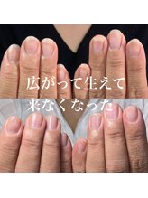 スティラ(Stila)/自爪育成/深爪育成/ネイルケア