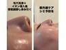 【毛穴洗浄+シミ予防ビタミンC電子導入】夏の紫外線ケア　夏期間全員5,000円