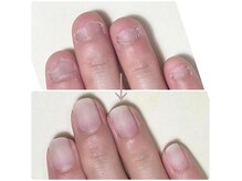 リッカの雰囲気（子供の頃からの噛み爪さんが、こんなのに爪が伸びました！）