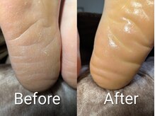 プレヴナンス(Prevenance)