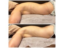 サローネ パルマ(salone PALMA)の雰囲気（〈痩身〉引き締め）