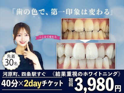 ホワイトニングショップ 四条店の写真