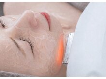 エナ(ENA)/光フェイシャル「美白ケアに◎」