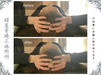 ボディ リセット アンド デザイン(Body Reset & Design)/【施術例】ビフォーアフター