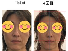 ベル/50代の方の小顔Before After