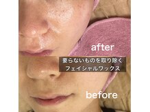 ノヘアン(noheanc)の雰囲気(美肌の土台作りにはフェイシャルワックス♪スキンケアの浸透up)