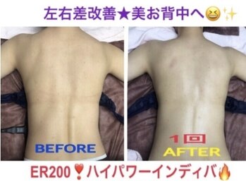 アルページュ(Arpege)/背中を集中的に引き締め美ライン