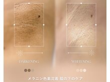 ミリミリ(milimili)の雰囲気（意外と見られている脇＊自信を持って服を着ましょう(*^^*)）