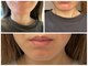 ケンビラク(Kenbiraku 健美楽)の写真
