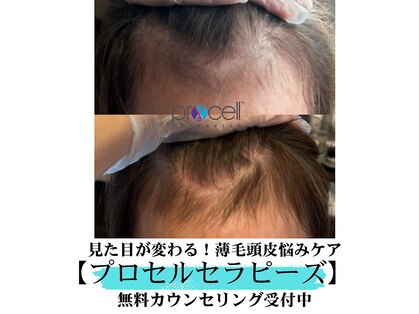 シャラ(shara)の写真