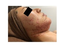 ココティー 恵比寿店(Cocotii)の雰囲気（グリーンピール『ビフォーアフターコンテストグランプリ受賞』作）