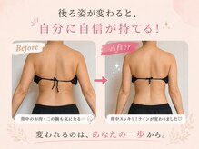 ヨサパーク アカーシャ(YOSA PARK AKASHA)/背中スッキリで見た目が変わる