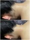 アンジュヴィバラヴィーダ(Ange viva la vida)の写真/初めての脱毛大歓迎◎産毛に効果ある機械★全箇所事前の自己処理不要はAngeだけ！全身剃らずに来店OK★