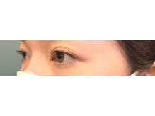 ラス 方南町駅前店(LATH)/6月★まつ毛