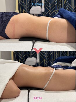 bou 新宿/お腹しっかり