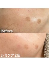 シュシュエステプリューム(Chou Chou Esthe PLUME)/