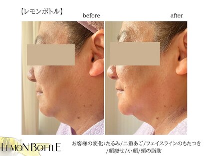 ジゼル(Giselle)の写真