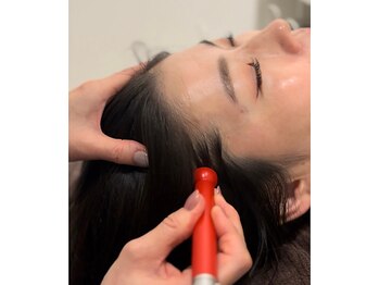 モリタ鍼灸整骨院/頭皮リリースで引き上げ