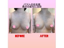 ベテランの技術＋光＋ナノカレント効果で戻らないバスト\14800