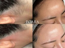 ポアラ(POARA)