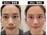 【首・肩・デコルテまで徹底小顔】自分に合った最新機器からお選び頂けます♪