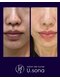 サロン ド ナース ユー ソナ(salon de nurse U.sona)の写真/韓国から日本上陸！インセルダムで叶える水光陶器肌★肌本来の力を底上げ＆育む◎本格的な肌質改善♪