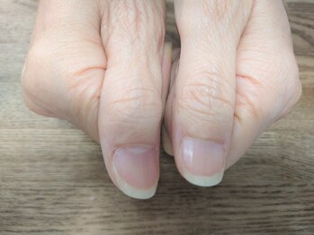 ケイアイエムネイル(KIM nail)/【自爪育成】自爪の育成改善に♪