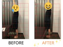 ベル/50代の方の姿勢Before After