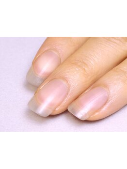 爪の悩みを解消できる（ケア含む）