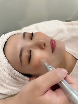 ディオーネ 梅田店(Dione)/【脱毛の強み】ゴッソリ毛穴洗浄