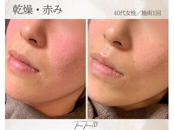 スリースリー(THREE THREE)/乾燥・赤みケア