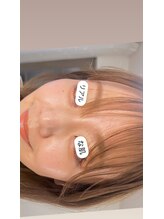 クレール 小山店(CLAIR)/【美肌フォト+エレポレ