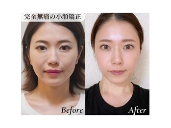 ル フラーズ(Les Fleurs)