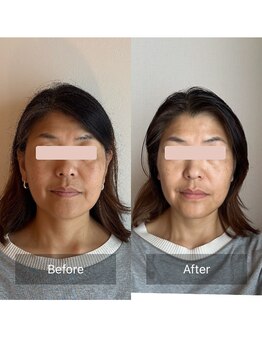 かぐや(salon)/ビフォーアフターのお写真