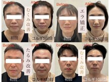 ビーキュート 姫路店(BE-CUTE)の雰囲気（それぞれのお悩みを改善し、美しい小顔に導きます☆韓国式コルギ）