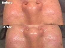 クリスタルビューティ 渋谷/NEW【XE'LHAセラピール】