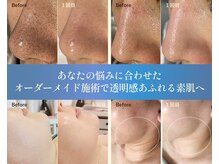 ルポ 鶴見(Repos)/1回でも透明感を実感頂けます！