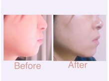 アンジェリカ(Angelica)/シャープなフェイスラインを