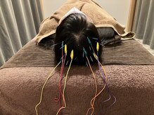 徳島藍住整骨院 ザ ビー(THE B)/極上睡眠鍼