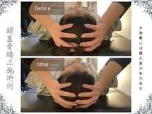 ボディ リセット アンド デザイン(Body Reset & Design)/【施術例】ビフォーアフター