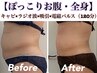 【ぽっこりお腹】キャビ×ラジオ波×セル分解×電磁パルス（120分）¥18700→