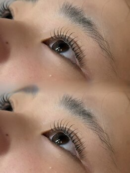 テント テン トータルビューティ(tent ten total beauty)/担当:藤戸　ラッシュリフト上